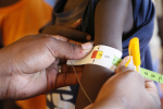 Avustustyöntekija mittaa lapsen käsivarren ympärysmittaa aliravitsemuksen selvittämiseksi Keniassa.