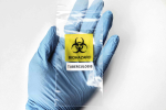 Käsi sinisessä kumihansikkaassa ja muovilappu, jossa lukee "biohazard tuberculosis".